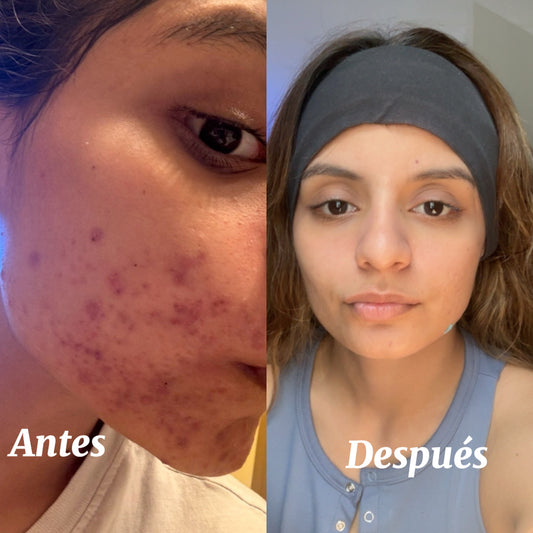 Niacinamida — Limpiador exfoliante iluminador