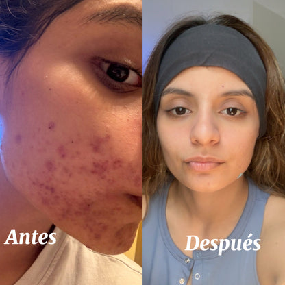 Clear Skin Duo